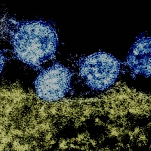Coronavirus Wuhan et cellule humaine.